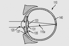 Google wants to inject cyborg lenses into your eyeballs